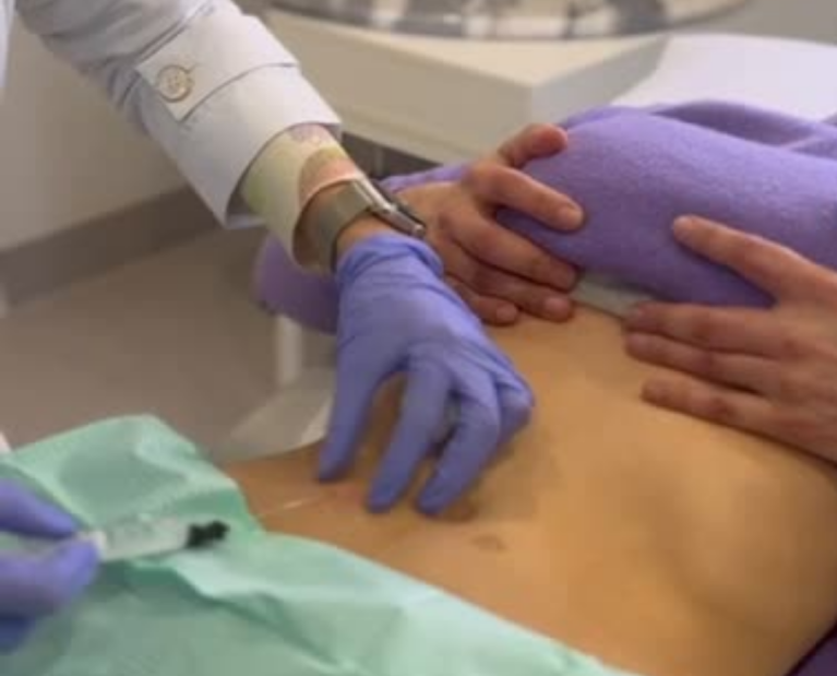 tratamento para flacidez da pele corporal no Porto