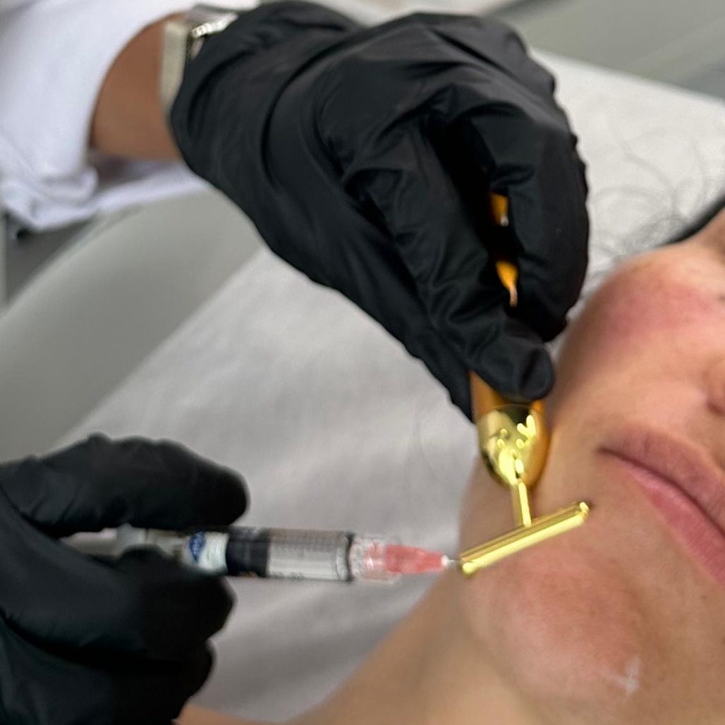 Bioremodulador