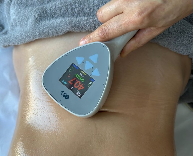 tratamento Exilis para gordura localizada no Porto